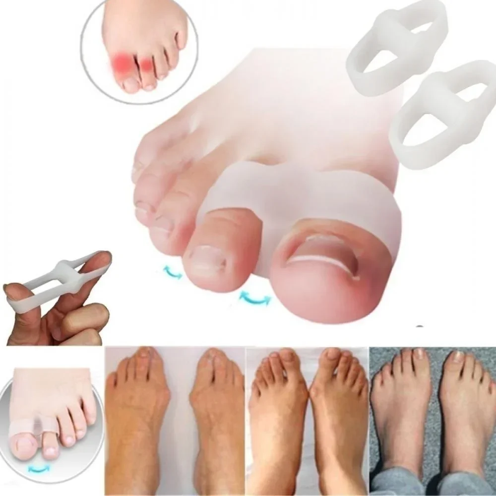 2 Holes Bunion Corrector Pain  – обзор и цена Correction Fluid White