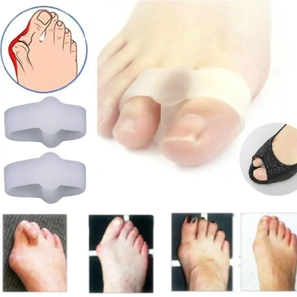 2 Holes Bunion Corrector Pain  – обзор и цена Correction Fluid White